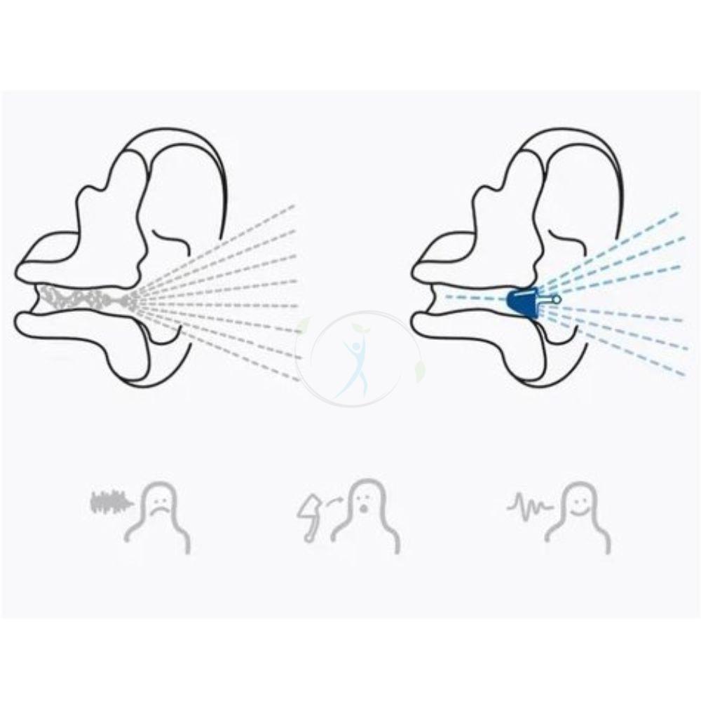 Flare Calmer® kids Secure 